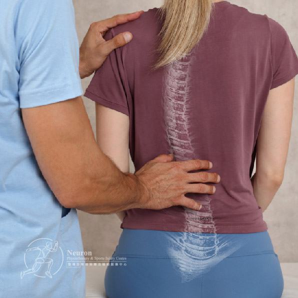 脊椎側彎, 脊椎側彎物理治療推薦｜Neuron 復健坊物理治療及運動創傷中心 -pic3