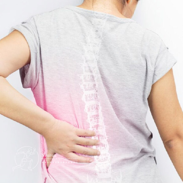 脊椎側彎, 脊椎側彎物理治療推薦｜Neuron 復健坊物理治療及運動創傷中心 -pic2